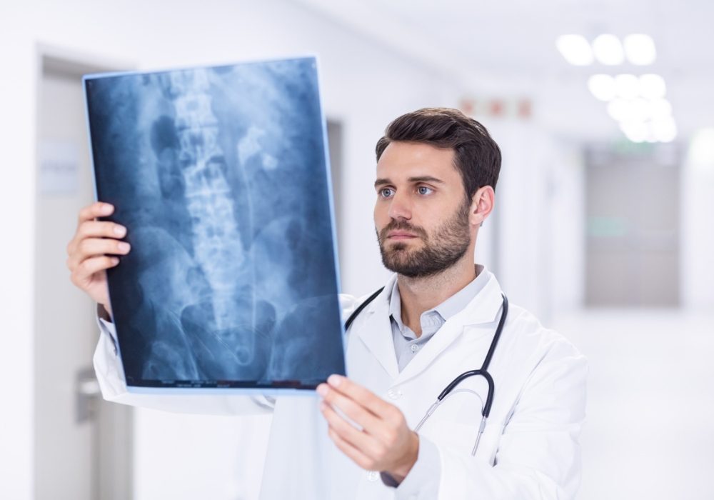 A doctor holding up an x-ray in El Paso.