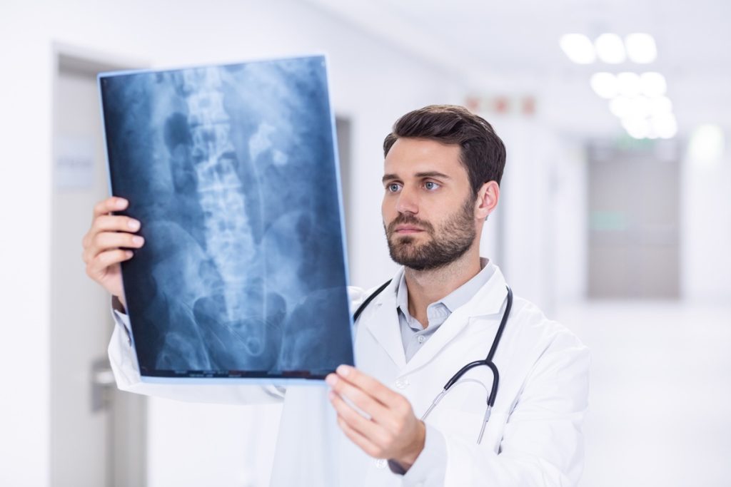 A doctor holding up an x-ray in El Paso.